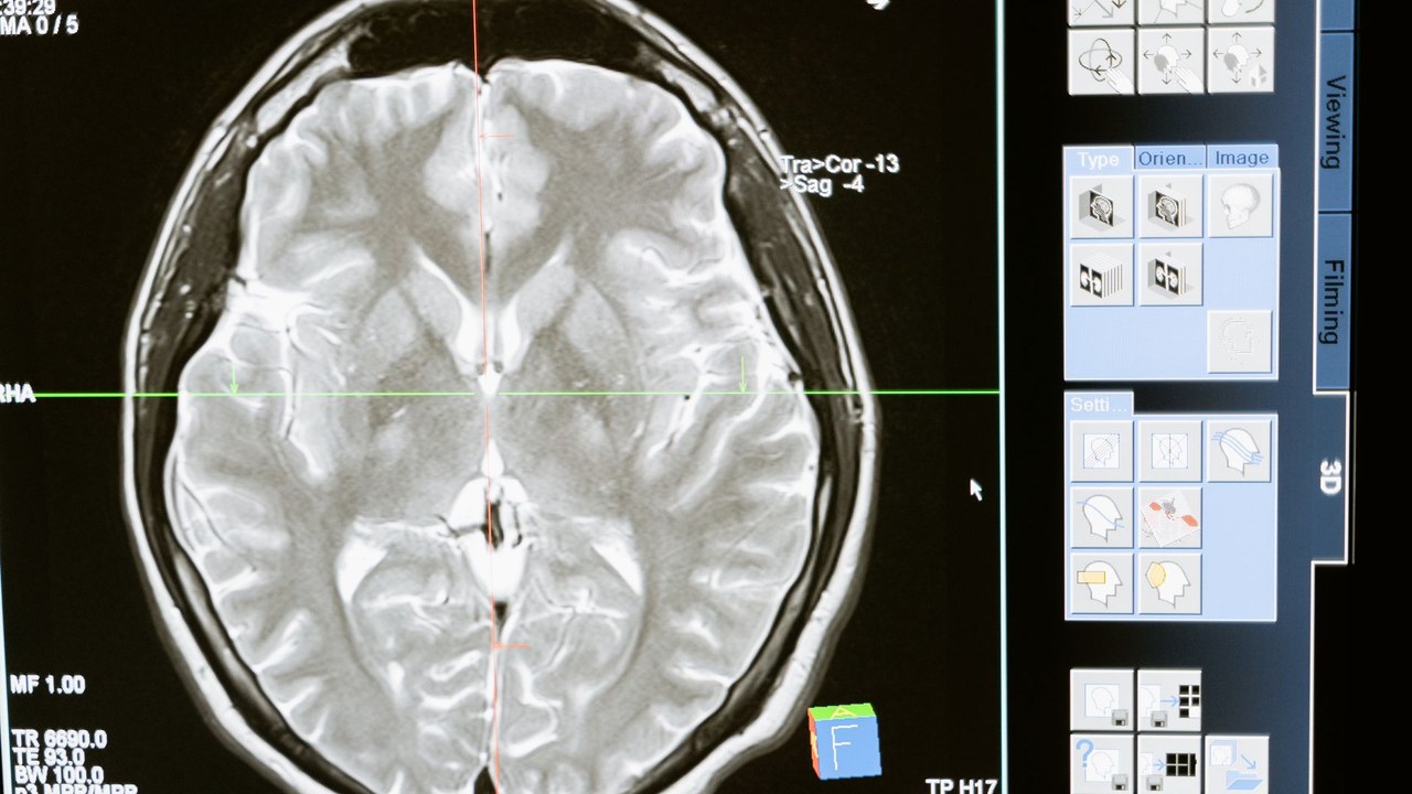 An illustration of the hippocampus, highlighting its role in memory formation and the impact of angiotensin on this process