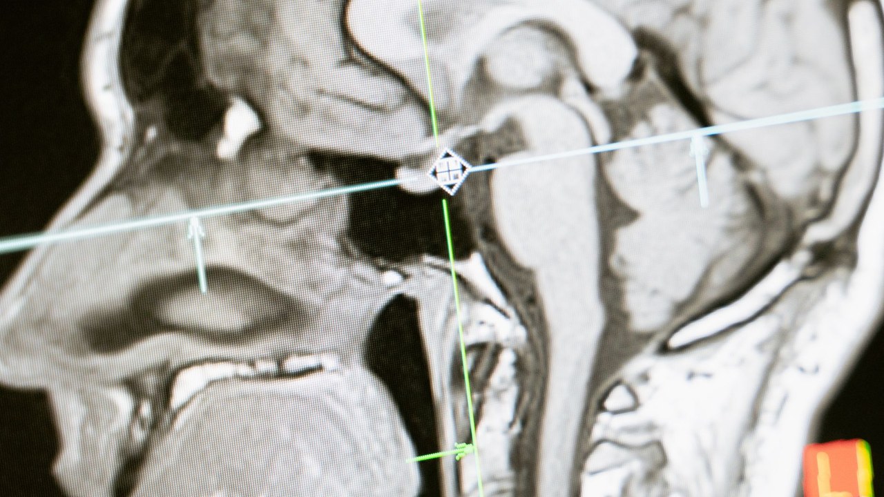 A detailed illustration of the brain with its various regions highlighted, focusing on the role of angiotensin in brain function