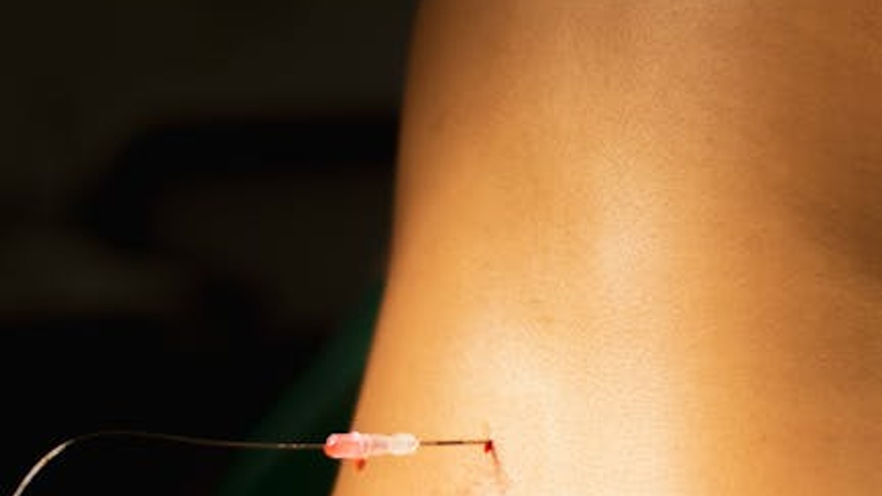 Diagram showing recommended subcutaneous injection sites on the human body.