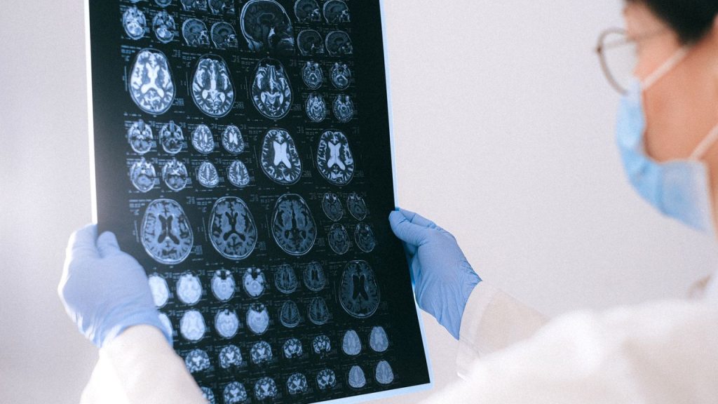 What Is IGF-1 LR3 and Its Role in Neurogenesis