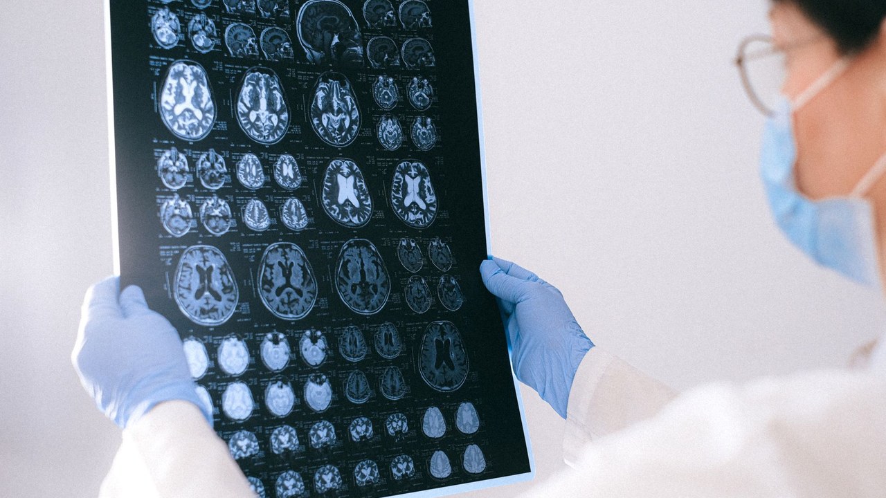 What Is IGF-1 LR3 and Its Role in Neurogenesis
