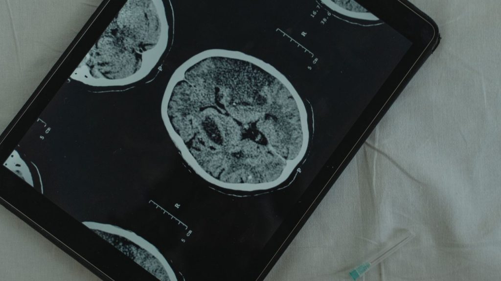 What Is PT-141 Peptide and Its Neurological Effects
