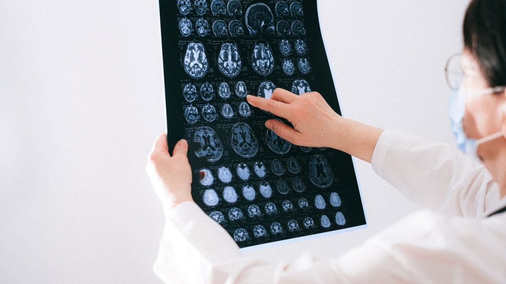 What Is Semax Peptide and Its Brain Benefits